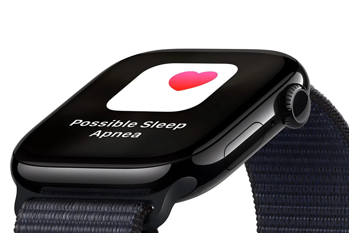 apple watch series 10 aluminum side 66dff8b1e404d665a09e0673 scaled 1