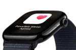 apple watch series 10 aluminum side 66dff8b1e404d665a09e0673 scaled 1